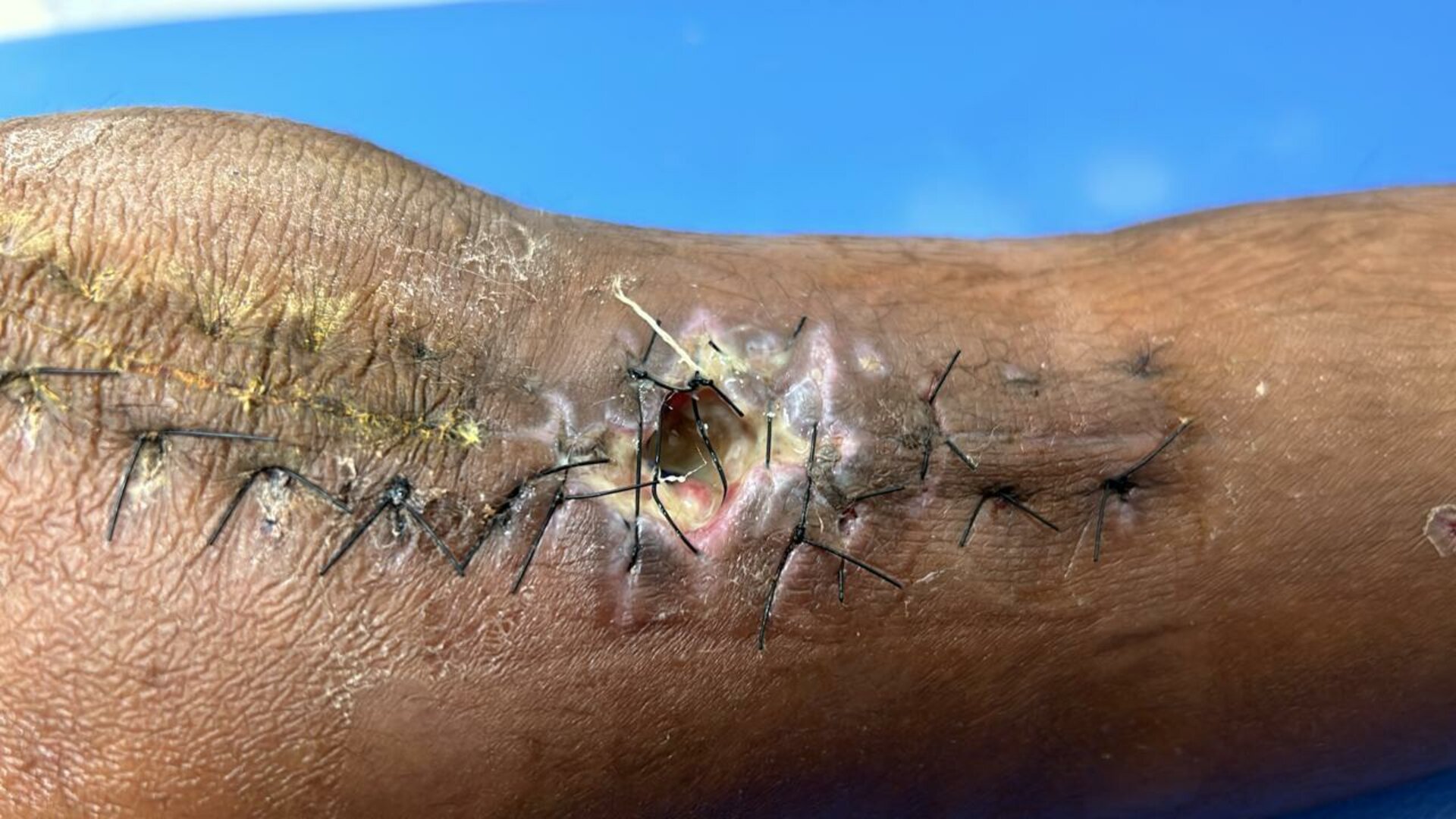 Dr. Preeti S. Ajapuje's Center for Infectious Disease|Koregaon Park,Pune